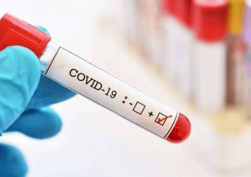 448 pacientë të shtrirë me koronavirus në QKUK, 41 në gjendje të rëndë