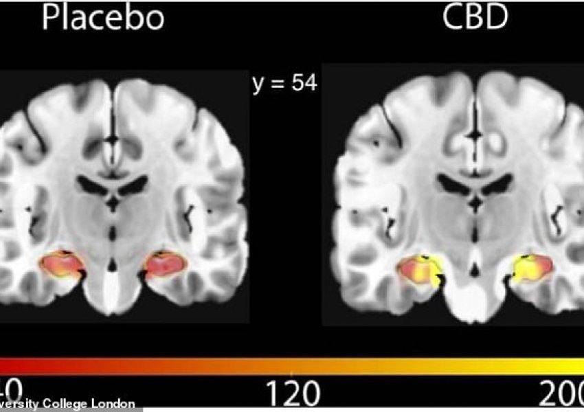 Vaji i kanabisit përmirëson funksionimin e trurit, tregon studimi