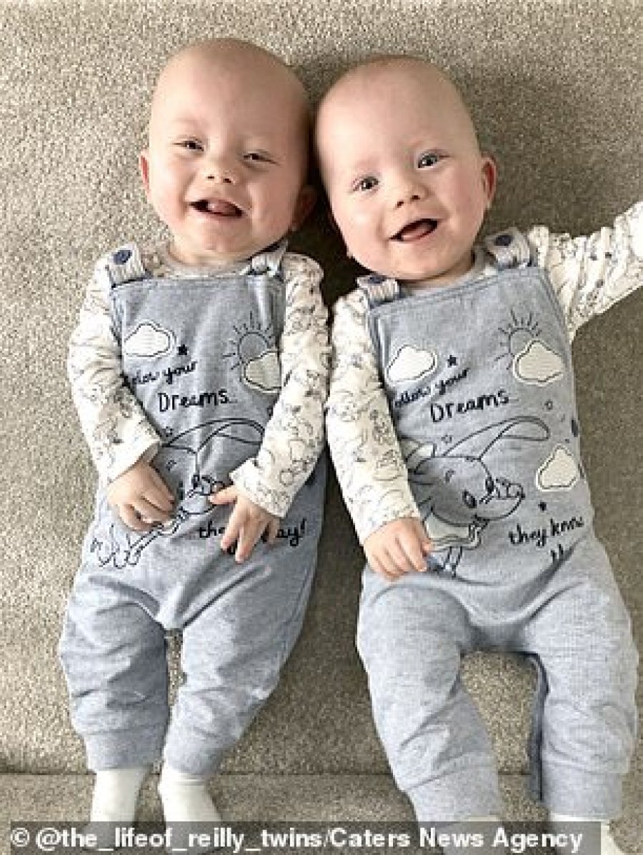 Mamaja lind binjakët me dy ditë diferencë nga njëri-tjetri