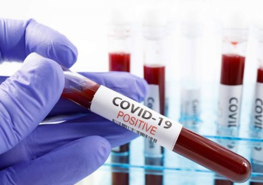 64 të vdekur nga koronavirusi në Kosovë