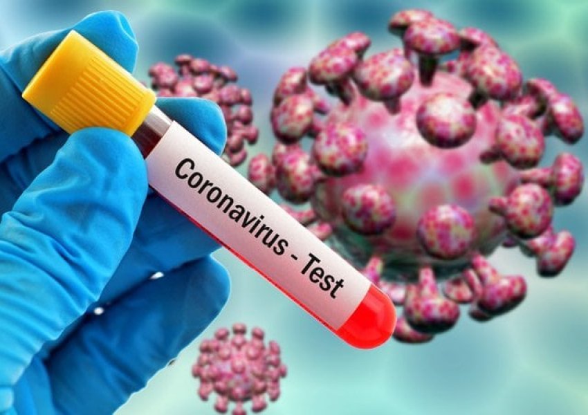 Sa vdekjeprurës është koronavirusi?