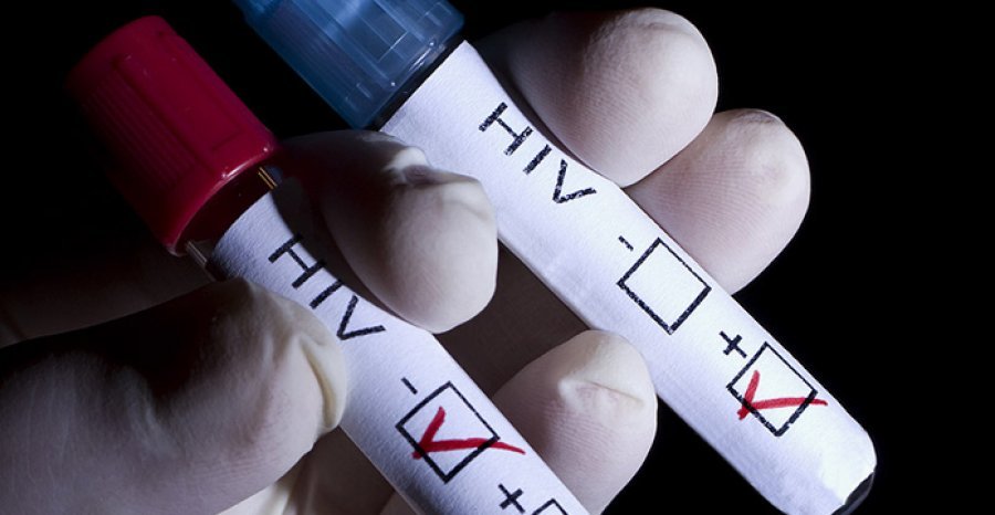 OKB ngre alarmin: Koronavirusi rrezikon betejën kundër HIV-it