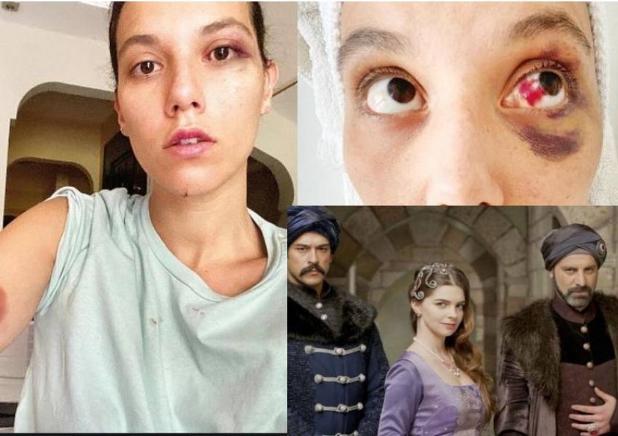 Aktori i serialit 'Sulejmani i madhërishëm' rreh brutalisht të dashurën