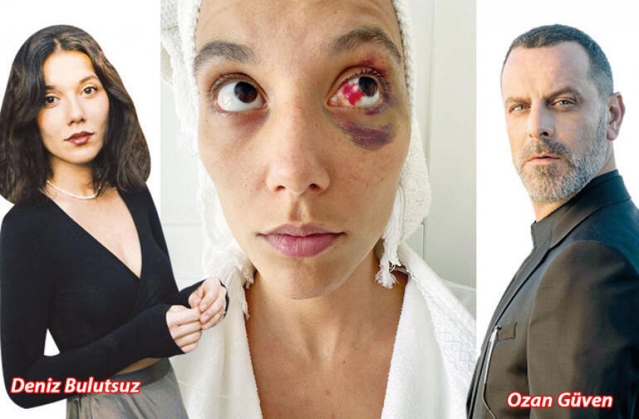 Rrahu brutalisht të dashurën, gjykata merr vendimin për aktorin e njohur turk 