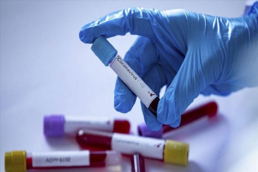 SHBA/Aprovohet testi i ri, rezultati nëse jeni i infektuar me koronavirus për 45 minuta