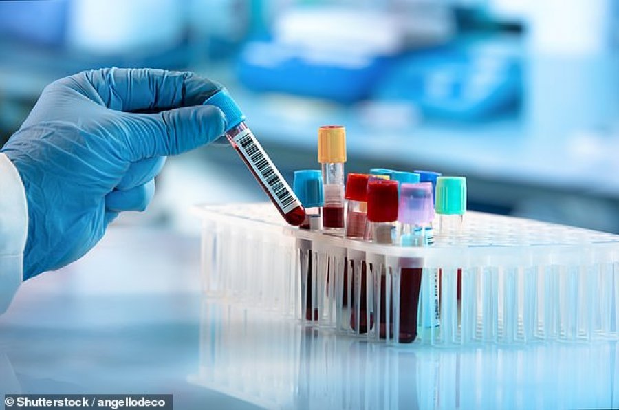 Shkencëtarët britanikë zbulojnë antitrupin që neutralizon koronavirusin