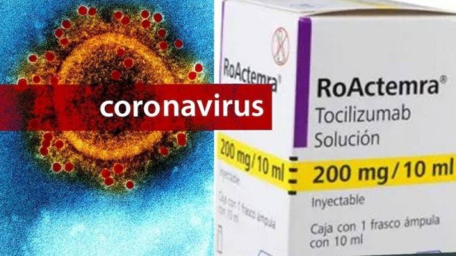 Ilaçi kundër artritit kundër COVID-19, reumatologu shqiptar: Po bëhen studime nga disa spitale   