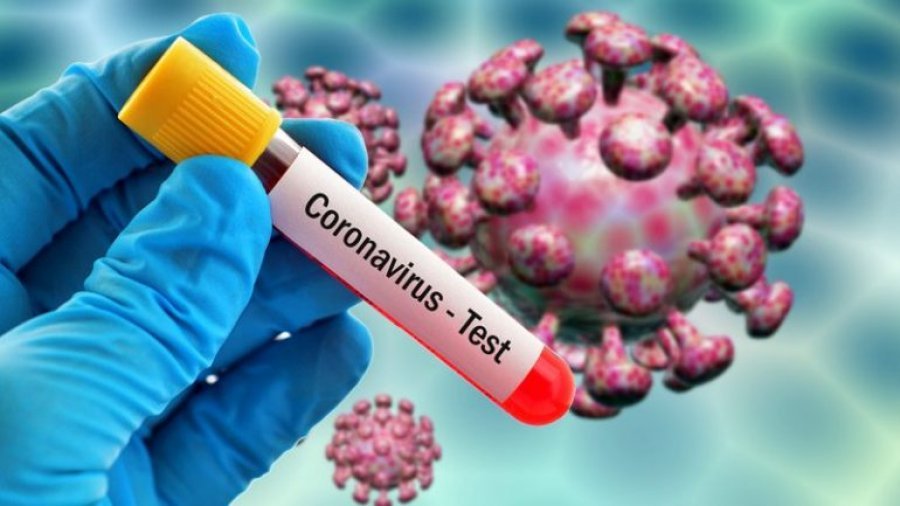 Rritet frikshëm numri i të prekurve nga koronavirusi në Maqedoni, 29 të infektuar në 24 orët e fundit