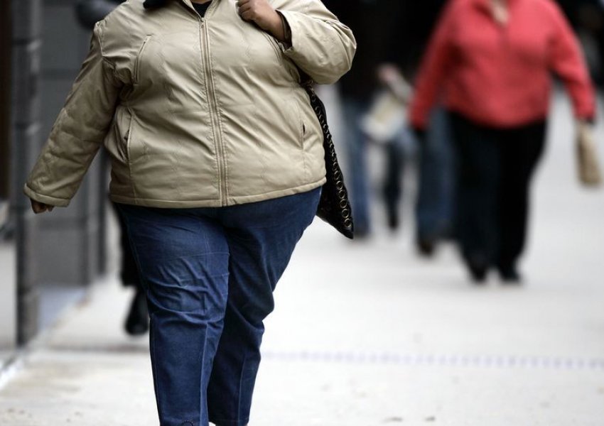 Obeziteti shkaktar më i madh i kancerit se sa duhanpirja