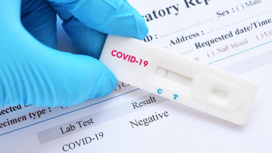 Testim për koronavirusin brenda pak minutave/ Kompania amerikane merr miratimin  
