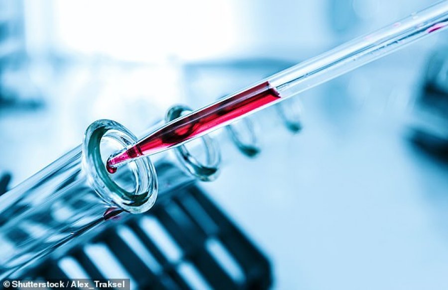 Kërkuesit amerikanë zbulojnë testin e gjakut, detekton 50 lloje kanceri