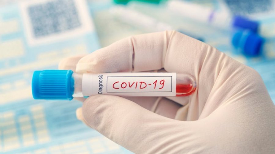 COVID-19/ Cila vitaminë mungon në 80% të pacientëve