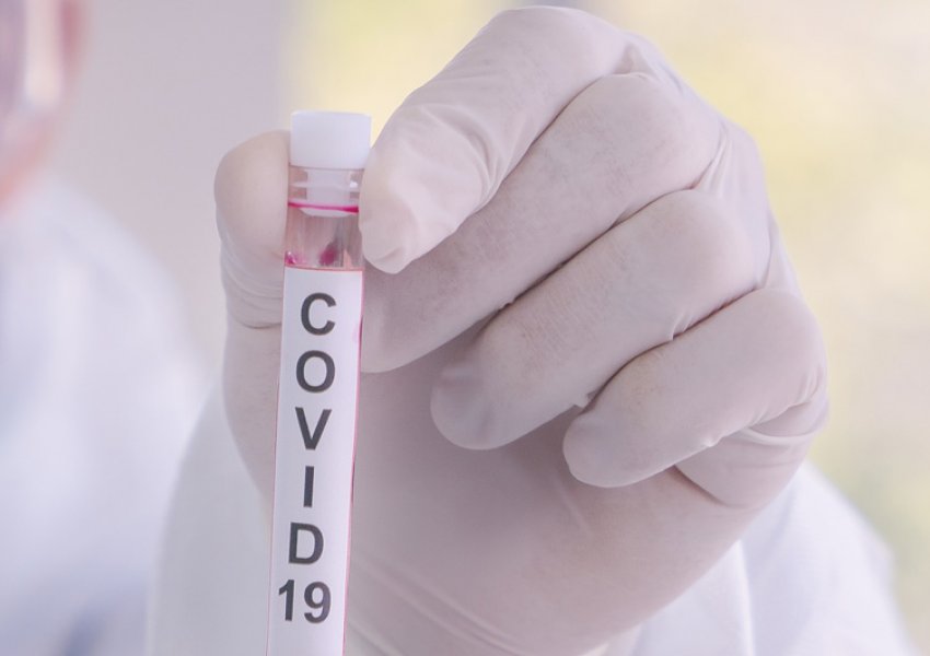 501 të infektuarit me COVID-19 vijnë nga këto komuna të Kosovës