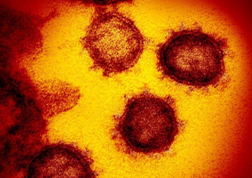 Studim i frikshëm: Covid-19 nuk është grip