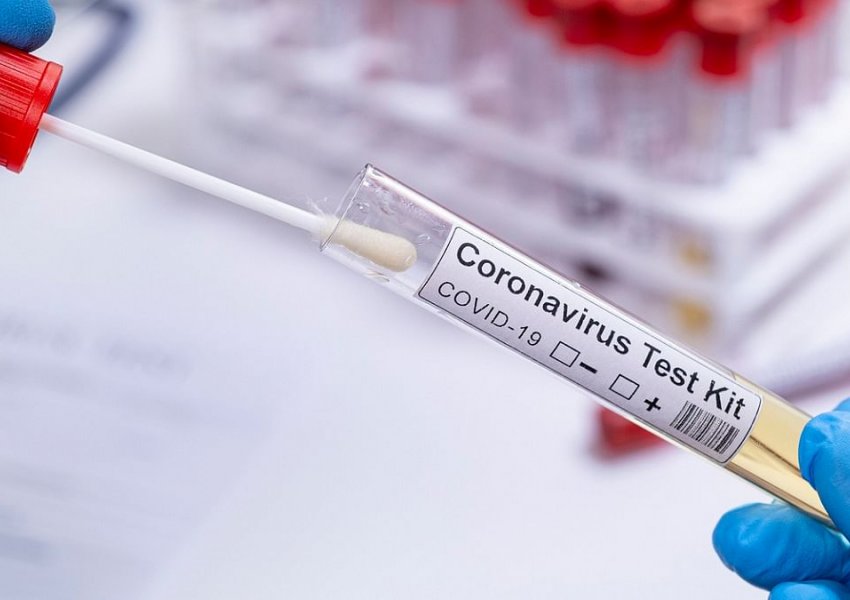 Mbi 20 milionë njerëz janë shëruar nga coronavirusi në botë