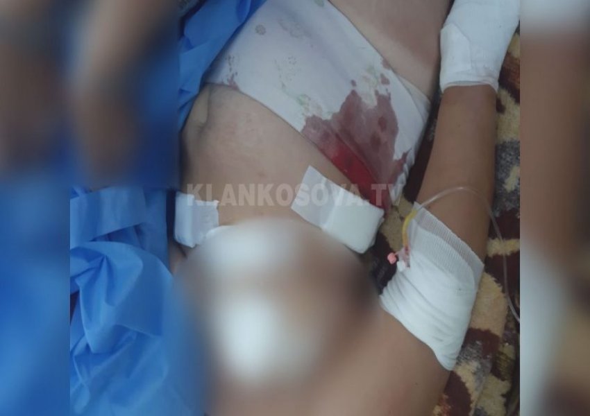 FOTO/ Pamje të rënda të gruas në spital, burri shqiptar e sulmoi 11 herë me thikë