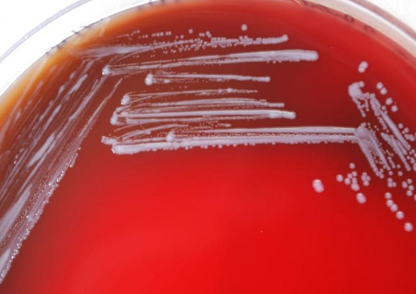 Bakteri arratiset nga laboratori në Kinë- infektohen mijëra
