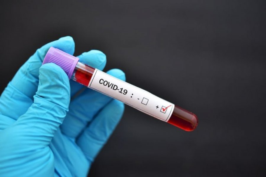 Sot, 13 mijë të infektuar me koronavirus në Kosovë 