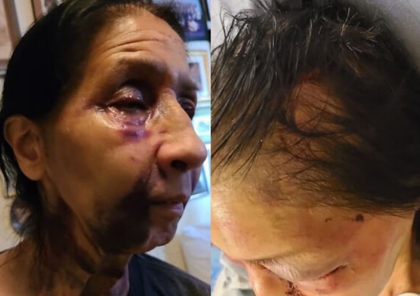 Sulm racist: Mendoi se ishte aziatike, rrihet brutalisht në autobusin e LA 70 vjeçarja