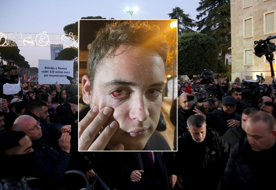 SYRI i Fabianit: Kur 'të shoqëron' Policia pas protestës!