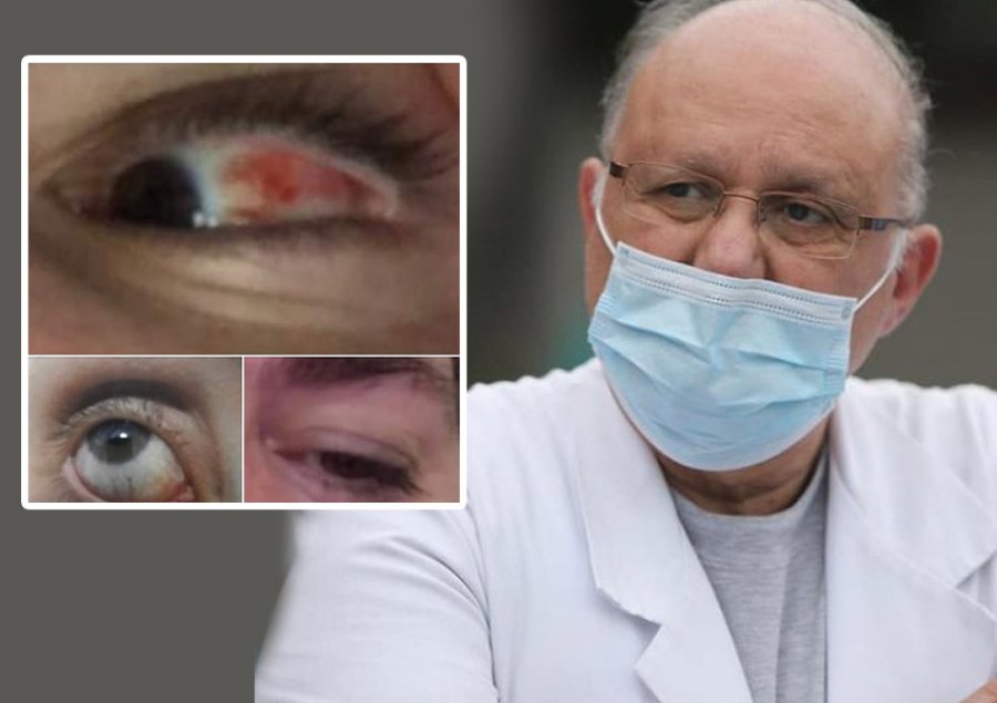 ‘Gripi i syrit’/ Mjeku Kalo apel qytetarëve: Ruhuni jo vetëm nga Covid