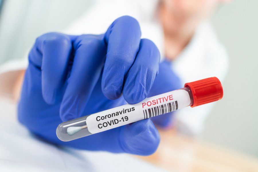 Studimi: Ndërlikimet nga koronavirusi prekin edhe të rinjtë