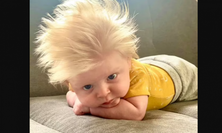 FOTO/ Shikojeni këtë bebe, ngjan si dy pika uji me Boris Johnson