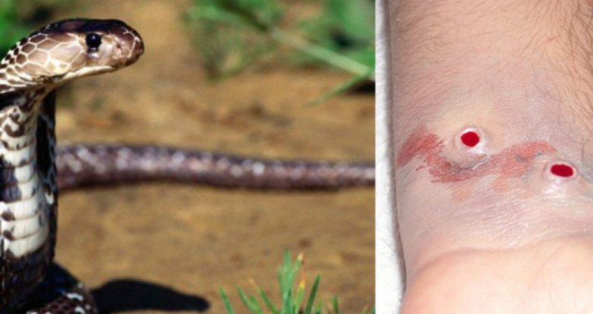 Kafshimi i gjarpërit dhe kujdesi mjekësor emergjent