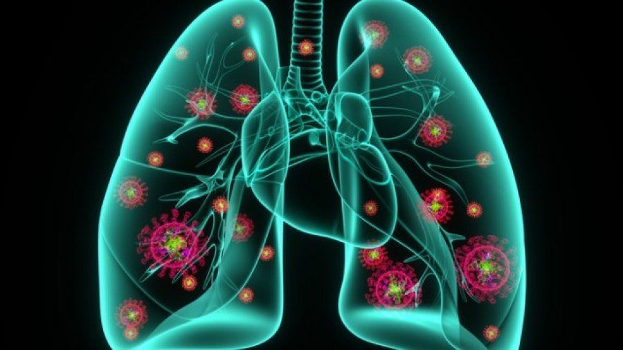 Pneumonia: Pesë shenja paralajmëruese që mushkëritë po dëmtohen nga COVID-19