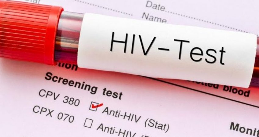 Më shumë meshkuj nën 20 vjeç të prekur nga HIV/AIDS në Shqipëri