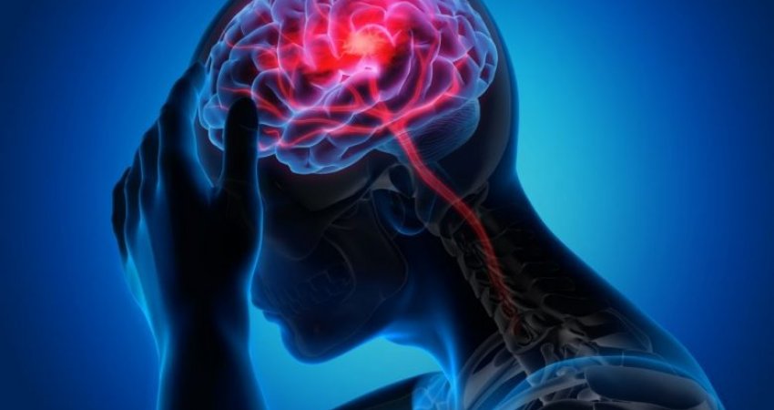 ​Pse migrena kronike është më shumë se një dhimbje koke