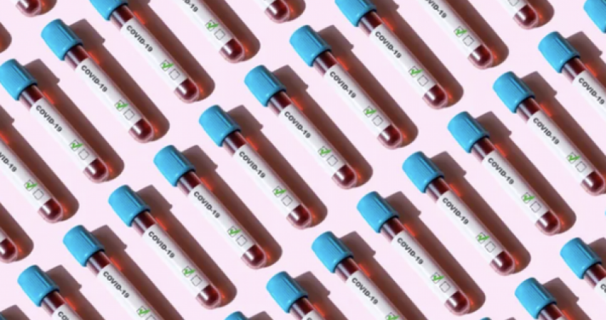 A duhet bërë një test antitrupash, nëse vaksina është duke funksionuar? Ekspertët japin përgjigjje