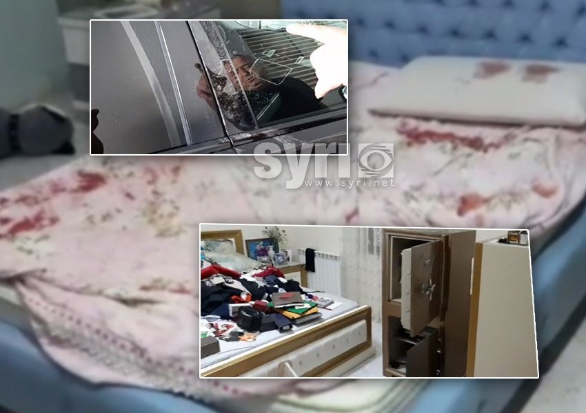 VIDEO - FOTO/ Biznesmeni rrëfen torturat që i bënë grabitësit: Më prenë gishtin me gërshërë…