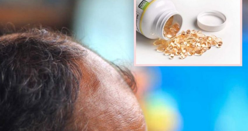 Mungesa e vitaminës D: Shenja paralajmëruese në kokën tuaj