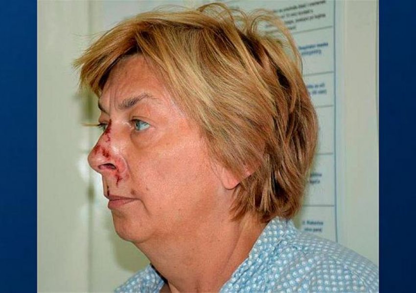 Policia kroate e identifikon gruan misterioze të gjetur në ishull: turiste sllovake