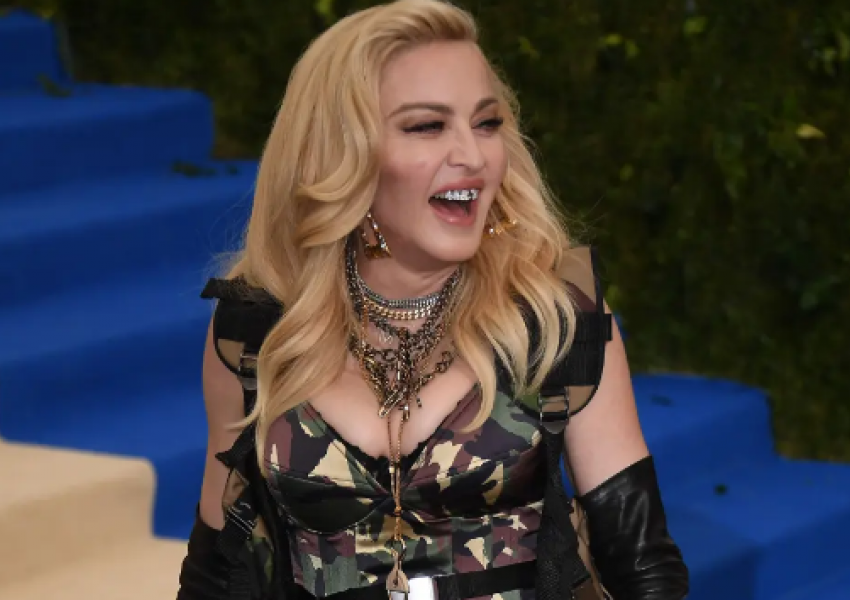 Madonna shpjegon se përse mban proteza në dhëmbë