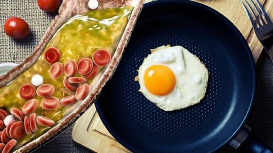 A mund të konsumoni vezë nëse keni kolesterol të lartë?
