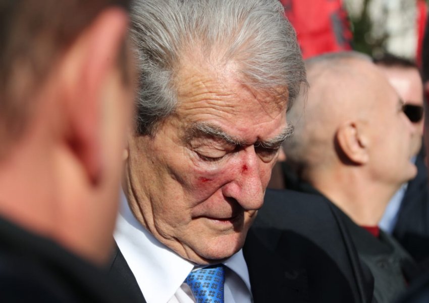 La Repubblica: Kryetari i opozitës shqiptare u qëllua në protestë paqësore
