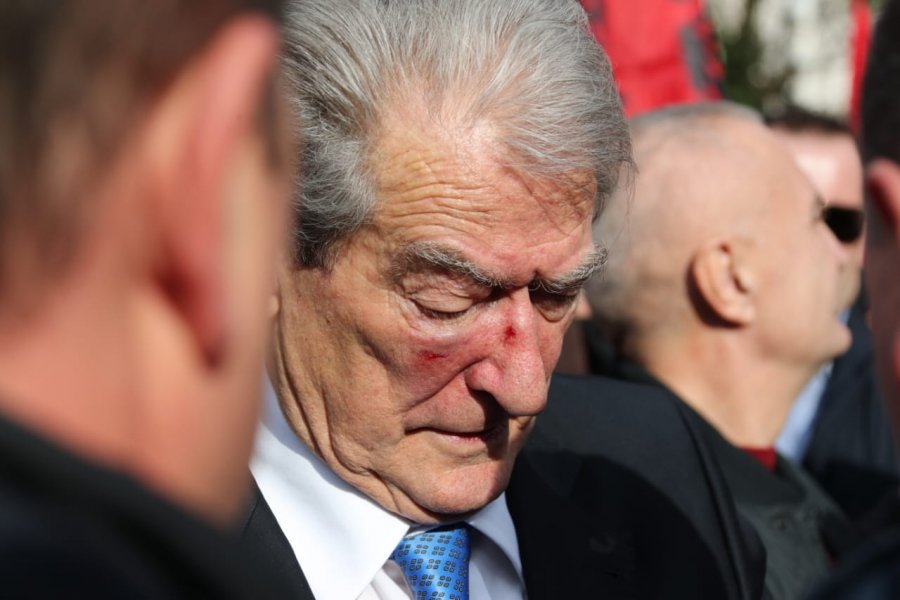 La Repubblica: Kryetari i opozitës shqiptare u qëllua në protestë paqësore