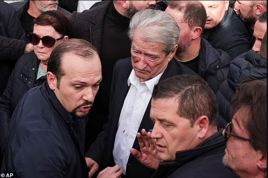 Fox News: Lideri i opozitës së djathtë shqiptare sulmohet gjatë protestës kundër qeverisë