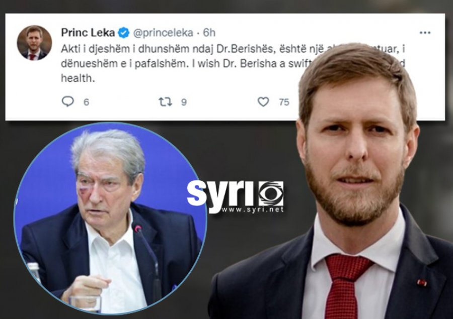 Princ Leka reagon për sulmin ndaj Berishës: Akt i shëmtuar, i uroj shërim të shpejtë doktorit