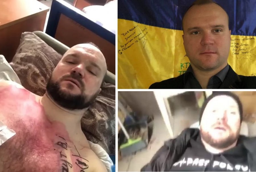 VIDEO/ Ai quhet Arnaut dhe nuk vdes: Veterani ukrainas i Anti-terrorizmit i mbijeton plagëve