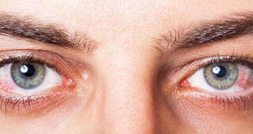 Problemet shëndetësore që tregojnë sytë, çfarë duhet të keni kujdes