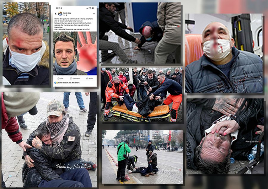 Demokratët u dhunuan nga mercenarët, Berisha publikon FOTOT: Kjo është fytyra gjakësore Rama-Basha