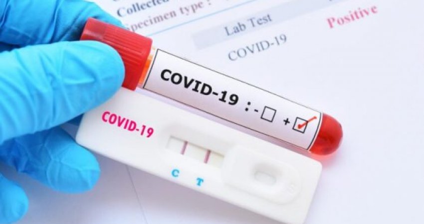 Rritet numri, afro 18 mijë raste aktive me koronavirus në Kosovë 