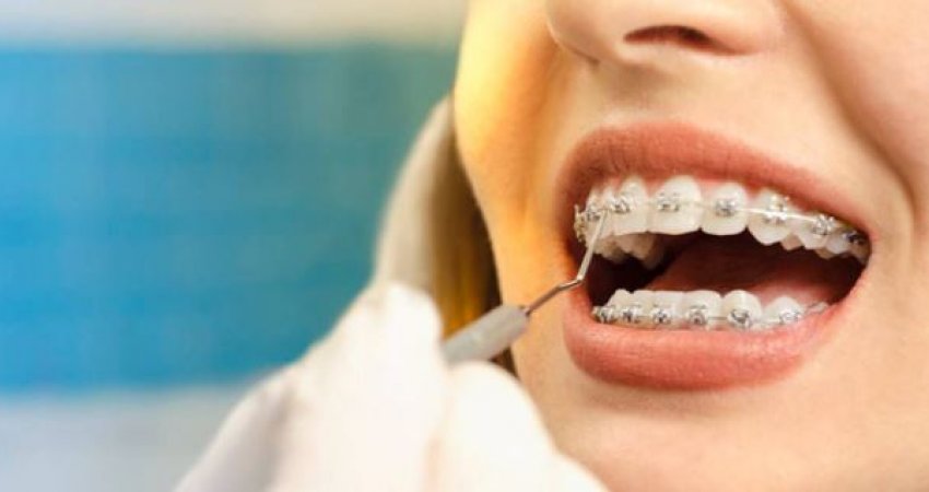 Disa ilaçe shtëpiake që ndihmojnë në shërimin e mishrave të dhëmbëve nga gjakderdhja