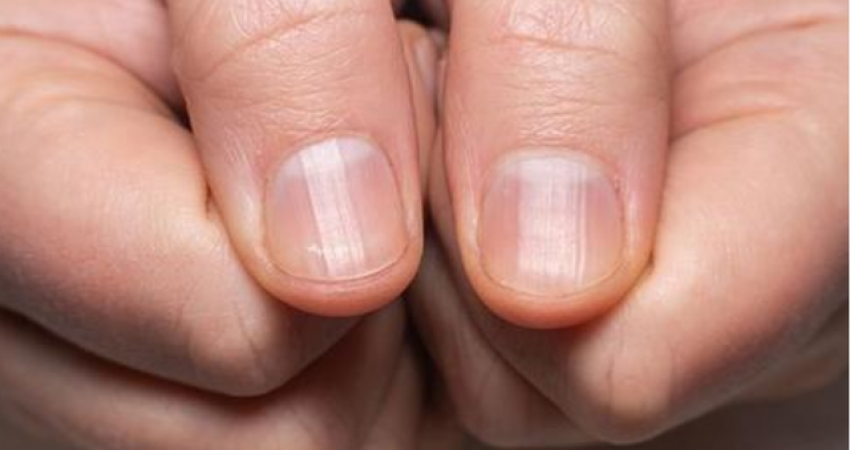 KUJDES! Gjatësia e gishtit mund të tregojë rrezikun për t’u prekur nga kanceri