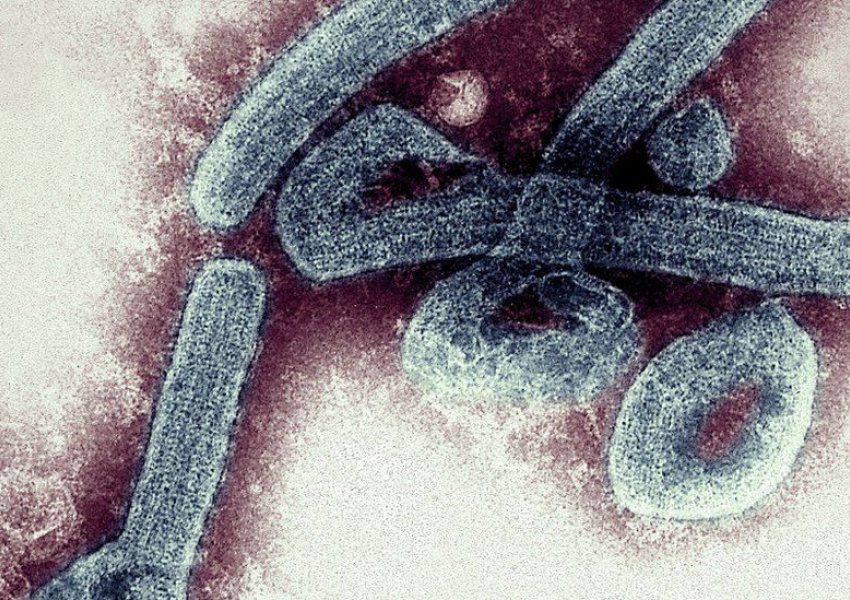 Gana konfirmon rastet e para të virusit vdekjeprurës Marburg