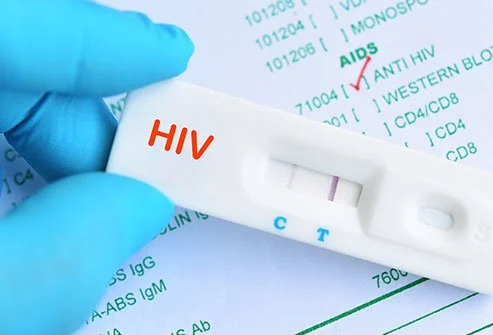 Thuhet se është shëruar pacienti i katërt në histori nga HIV-i