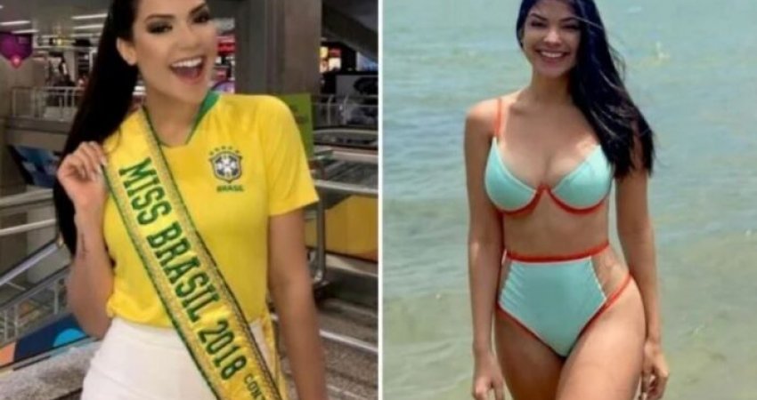 Ish-Miss Brazili vdes nga ataku kardiak pas operacionit në bajame